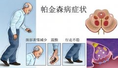 <b>奥博帕金森治疗仪管用吗?帕金森的成因及症状</b>